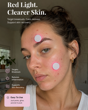ClearBeam LED Acne & Pimple Spot Patches