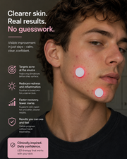 ClearBeam LED Acne & Pimple Spot Patches